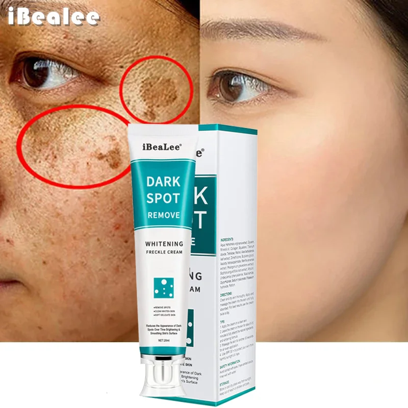 Licorice Root Sticks - Effektive aufhellende Sommersprossen-Creme, entfernt dunkle Melasma-Flecken,