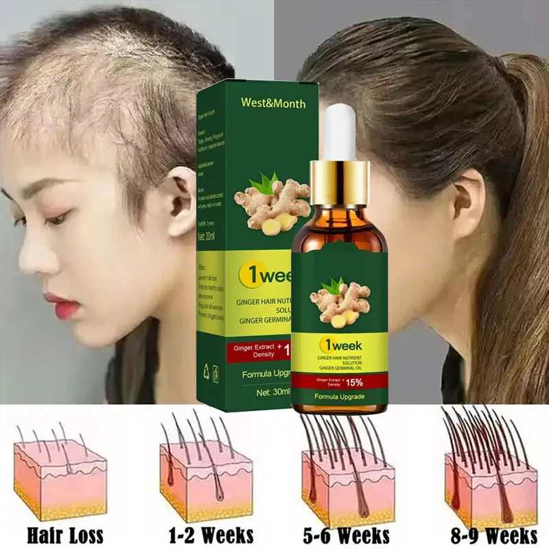 Licorice Root Sticks - 7 Tage Ingwer Haarwuchs Produkte schnell