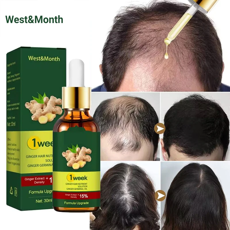 7 Tage Ingwer Haarwuchs Produk – Licorice Root Sticks Bewertung und Preis